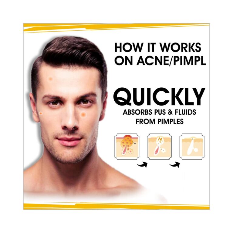 urban gabru Mens Acne Pimple Patch (72Pcs) - urban gabru