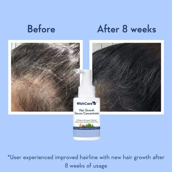 WishCare Hair Growth Serum Concentrate (30ml) - WishCare