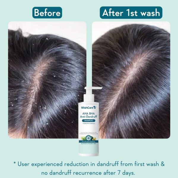 WishCare Hydrating AHA BHA Anti Dandruff Shampoo - Piroctone Olamine Salicylic Acid LHA (250 ml) - WishCare