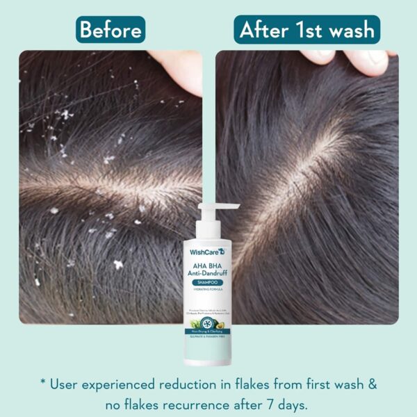 WishCare Hydrating AHA BHA Anti Dandruff Shampoo - Piroctone Olamine Salicylic Acid LHA (250 ml) - WishCare