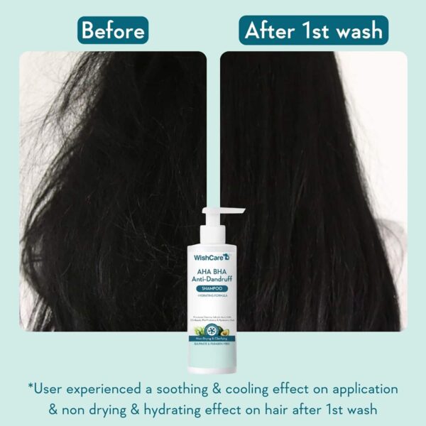 WishCare Hydrating AHA BHA Anti Dandruff Shampoo - Piroctone Olamine Salicylic Acid LHA (250 ml) - WishCare