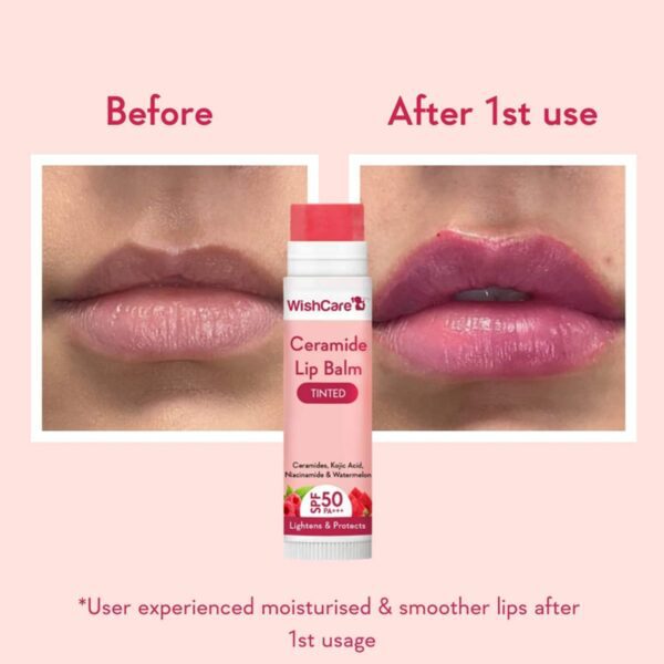 WishCare Tinted Ceramide Lip Balm with SPF 50 PA+++ Kojic Acid & Niacinamide (5g) - WishCare